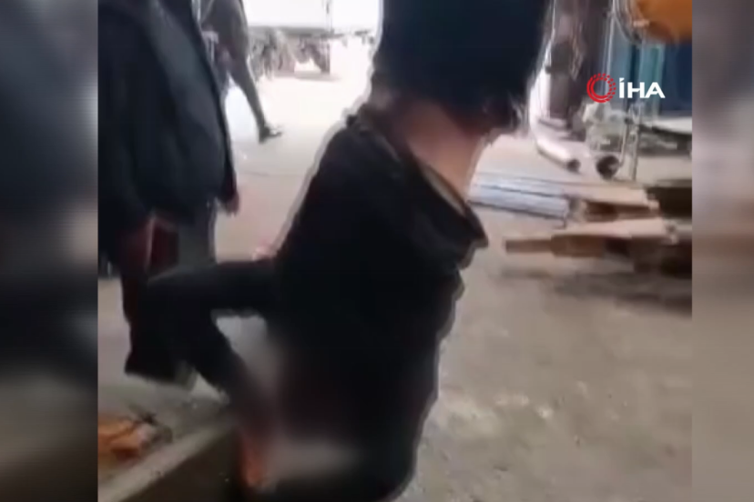 Zihinsel engelli şahsı ayağından vince asan şahıslar gözaltına alındı