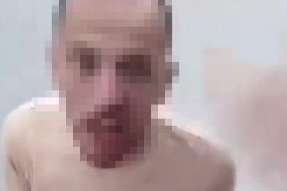 Kazaya sinirlendi, meslektaşına demir sopayla saldırdı
