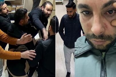 Rapor isteyen hastaya yumruk attı yüzde 30 görme kaybına neden oldu. Doktora 2,5 yıla kadar hapis istemi