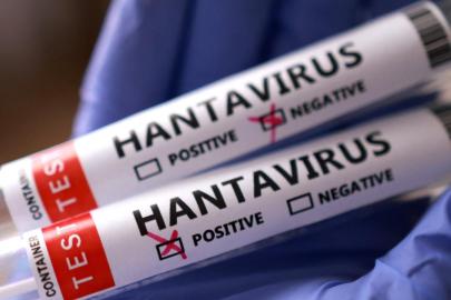 Sağlık Bakanlığından 'hantavirüs' açıklaması: Türk vatandaşların test sonuçları negatif