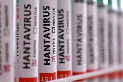 Türkiye'de hantavirüs vakası var mı? Sağlık Bakanlığı'ndan açıklama