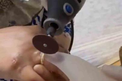 Kazada yaralanan kadının parmağına sıkışan yüzüğü itfaiye ekipleri çıkardı