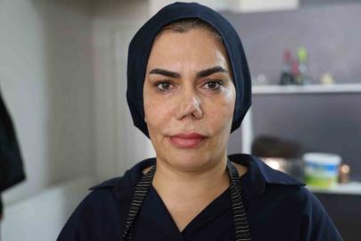 Bakım merkezinde burnu kırıldı, iyileşmek için geçirdiği 4 operasyon sonrası hayatı kabusa döndü